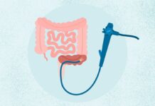 Ректороманоскопія: детальний посібник із процедури, ризиків та альтернатив