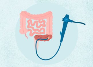Ректороманоскопія: детальний посібник із процедури, ризиків та альтернатив