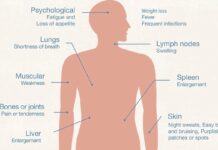 Лейкемія: розуміння симптомів і типів