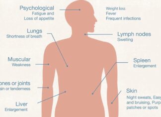 Лейкемія: розуміння симптомів і типів