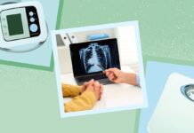 Ревматоїдний Артрит: Вплив на Тривалість Життя