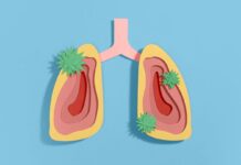 Тяжкі Респіраторні Інфекції Пов’язані з Підвищеним Ризиком Рака Легких