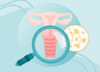 Вагінальні дріжджові інфекції: всебічне керівництво